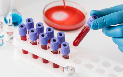 Анализы – Квинмед